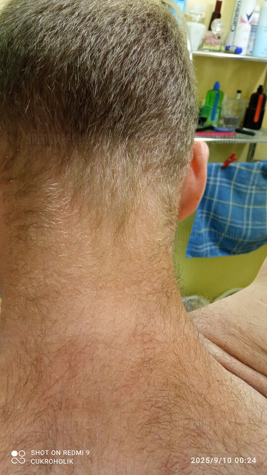 IMG_20250910_002453.jpg - sredniapoczwara