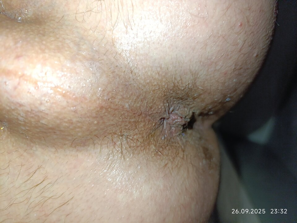 1000003876.jpg - Stifler601