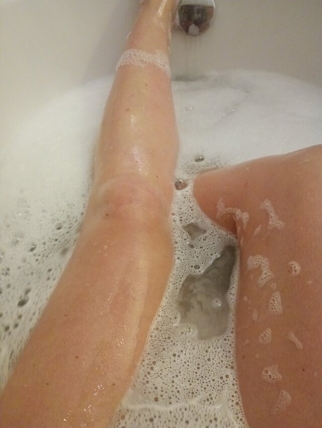 Ivi35