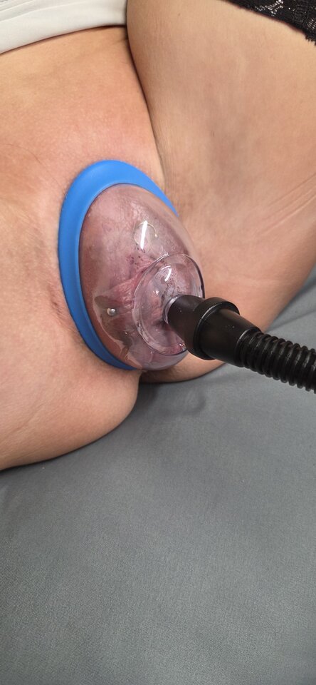 1000016950.jpg - parkaparka