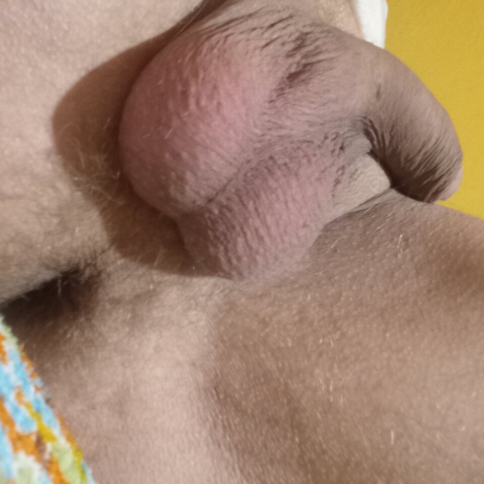 1000008852.jpg - brus13