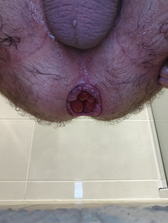 fistman
