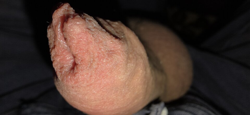 Napletek - Fiutkutaschujjaja