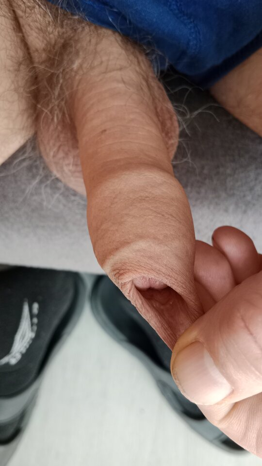 1760954583384279513947850580241.jpg - eroteooo