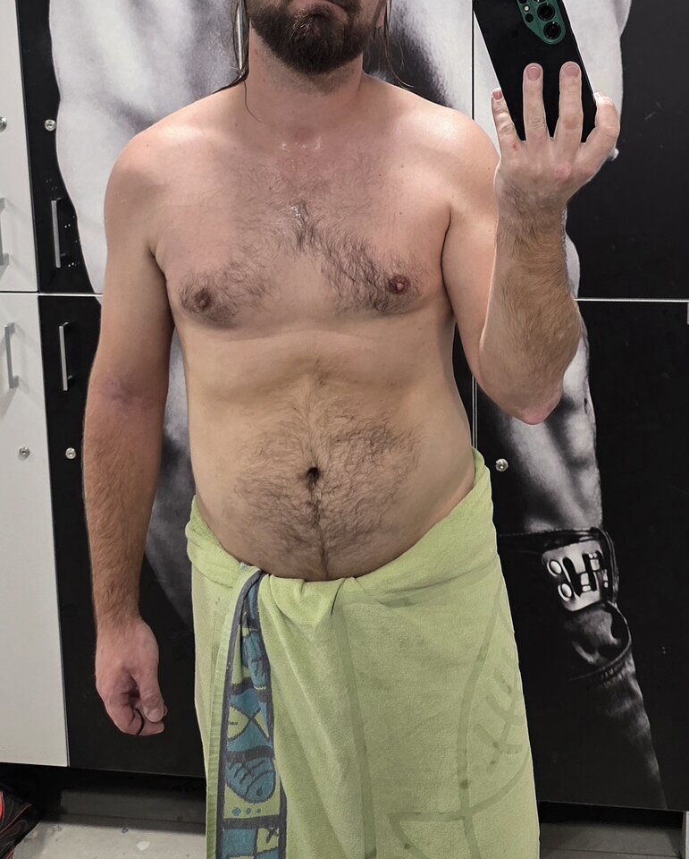 1000017864.jpg - toxict